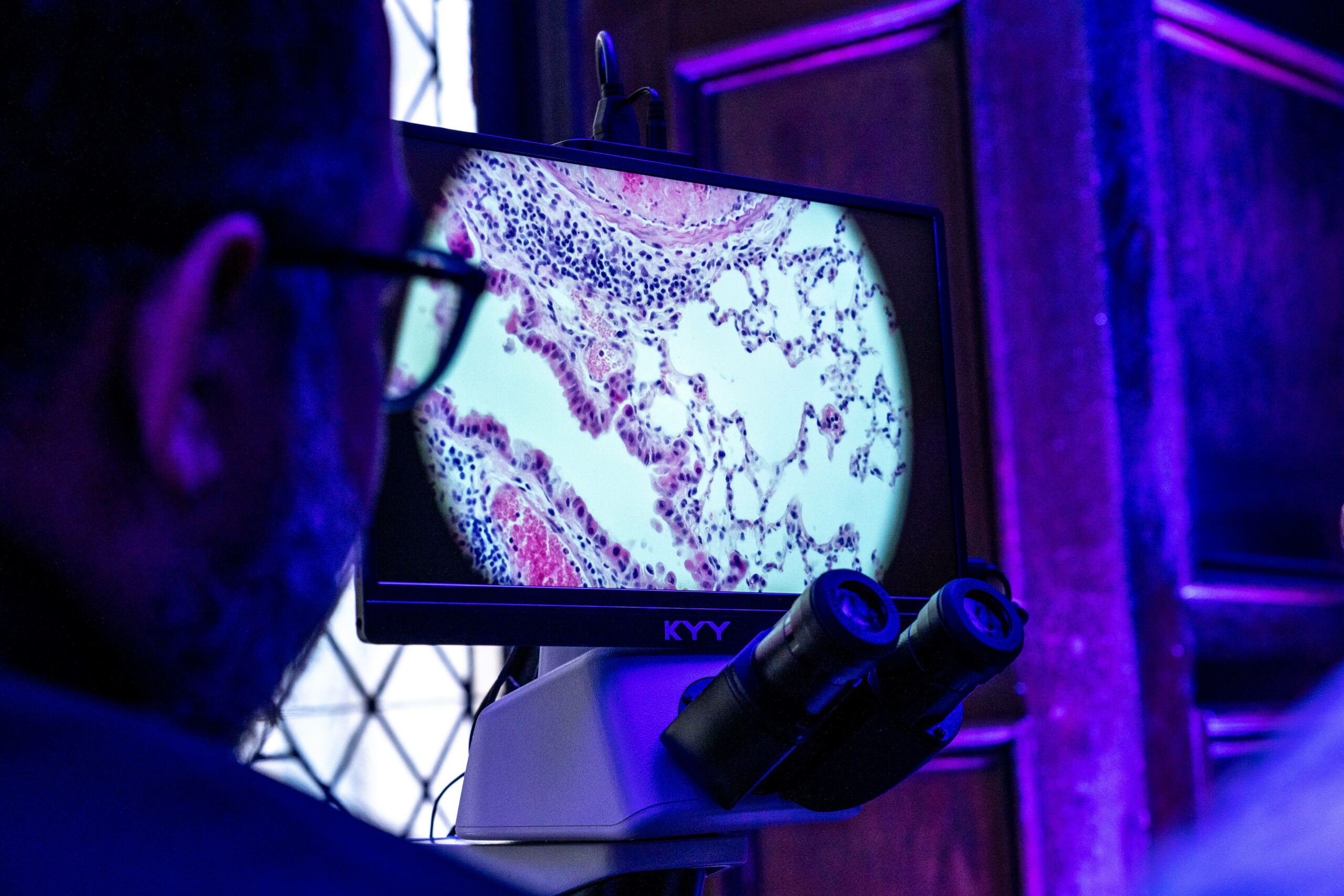 heart cells on microscope screen